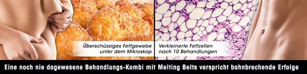 Melting-belts-Fette-Beitragsbild